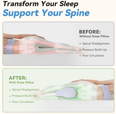 UJPFEO Knee Pillow for Side Sleepers, Leg Pillows for Sciatica, Joints Between - Image 2