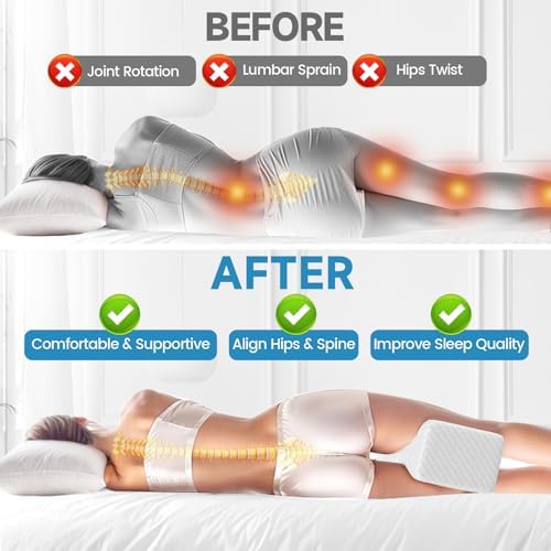 SweetSlubr Memory Foam Knee Pillow - Image 4