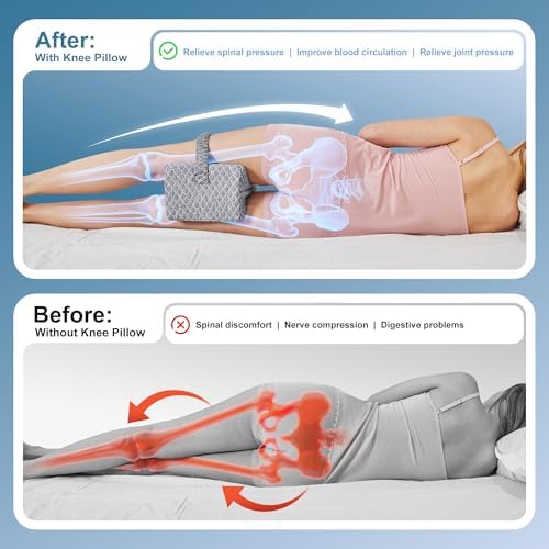 UJPFEO Knee Pillow for Side Sleepers, Leg Pillow for Sciatica, Joints Pain - Image 4