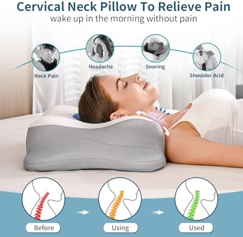 Cervical Neck Pillow for Pain Relief - Image 2