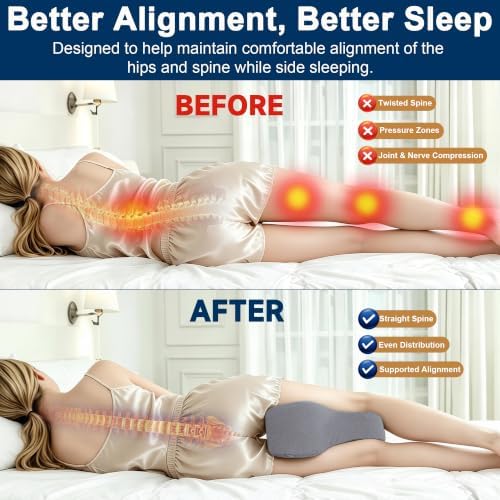 UJPFEO Knee Pillow for Side Sleepers, Leg Pillows for Sciatica, Joints Between - Image 2