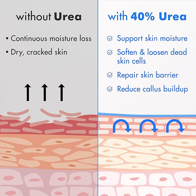 Ebanel Urea Cream 40% plus Salicylic Acid 2%, Foot Cream for Dry Cracked Heels Feet Knees Elbows Hands, Foot Dead Skin Cuticle Callus Remover Toenail Softener, Keratolytic Skin Barrier Repair, 2-Pack