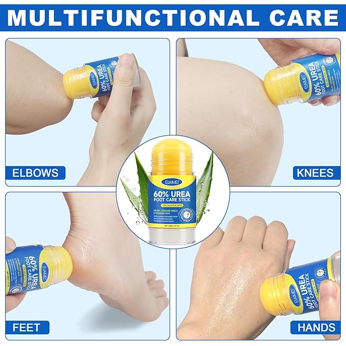 60% Urea Cream Stick with Salicylic Acid 2%, Urea Hydrating Foot Cream, Severe Cracked Heel Repair Restoring Balm, Foot Lotion Repairs and Hydrates Dry and Feet and Hand