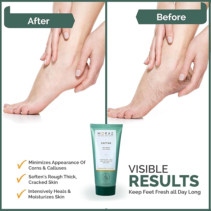 Moraz Caftan Polygonum Foot Cream for Dry Cracked Heels and Feet with 75% Polygonum Extract – Non-greasy, Fast-absorbing Intensive Foot Moisturizer for Dry Cracked Feet, Vegan, Paraben Free, 3.4 Fl Oz