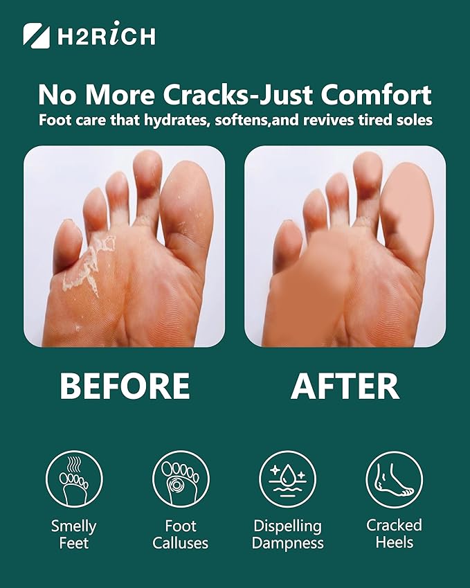 Hydrogen Foot Soak Effervescent Tablets 10 Pack | Ginger & Mugwort Herb Foot Bath, Relaxing Spa Pedicure Care | Improves Circulation, Soothes Tired Feet, Softens Calluses, Controls Odor