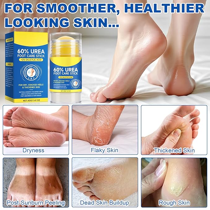 60% Urea with 2% Salicylic Acid Foot Care Stick, Urea Foot Cream Moisturizer for Dry Cracked Feet, Knees, Elbows, Hands, Moisturizes and Hydrates the Dry Skin 1Pack