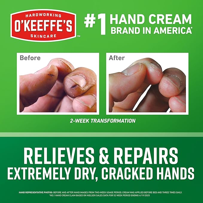 O'Keeffe's Working Hands Hand Cream for Extreme Dryness - 6.8 oz Value Size Jar (12 Pack) - Repairing Skincare for Cracked, Dry Hands