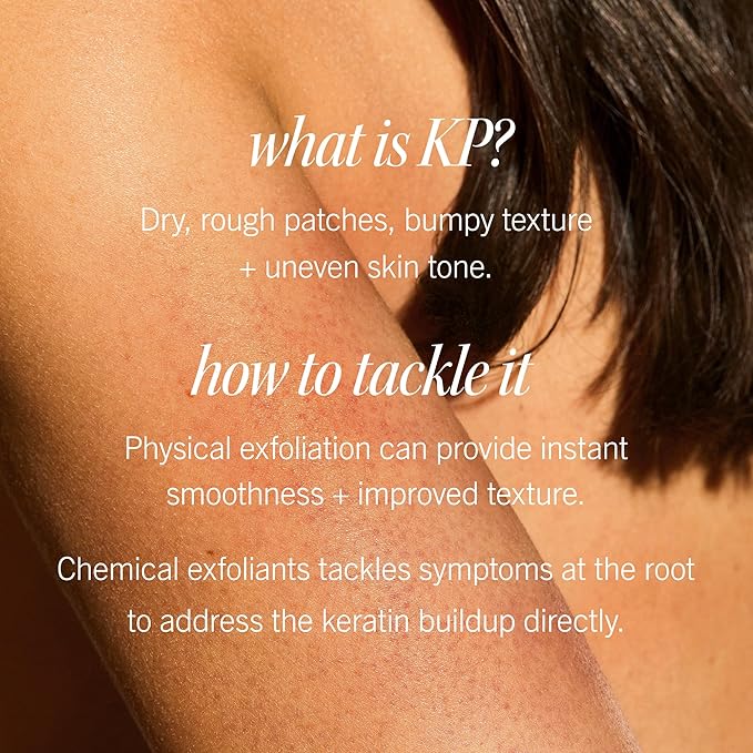 First Aid Beauty - KP Bump Eraser Body Scrub with 10% AHA, Keratosis Pilaris Skin Exfoliater with Glycolic and Lactic acids, Helps Reduce Chicken Skin Bumps, Safe for Sensitive Skin, 4 oz