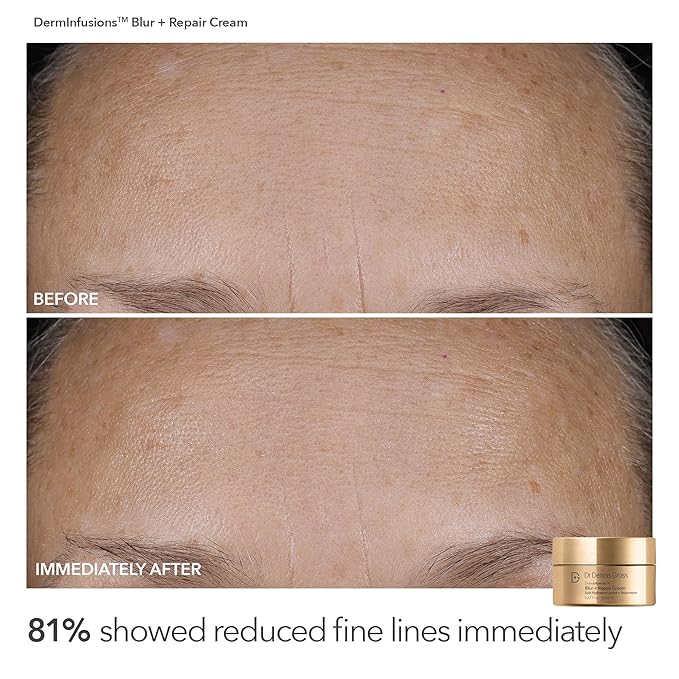 Dr Dennis Gross Plump & Smooth Limited Edition Kit – DermInfusions™ Blur + Repair Cream (0.67 oz) + 5 Alpha Beta® Universal Daily Peels | $50 Value